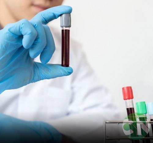 Pesquisadores da Holanda podem ter descoberto a cura para o HIV