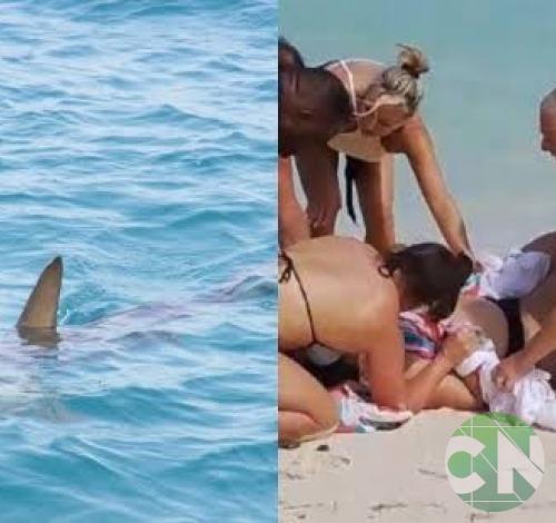 Mulher tenta fazer selfie com tubarão de 1,80 m e tem mãos devoradas